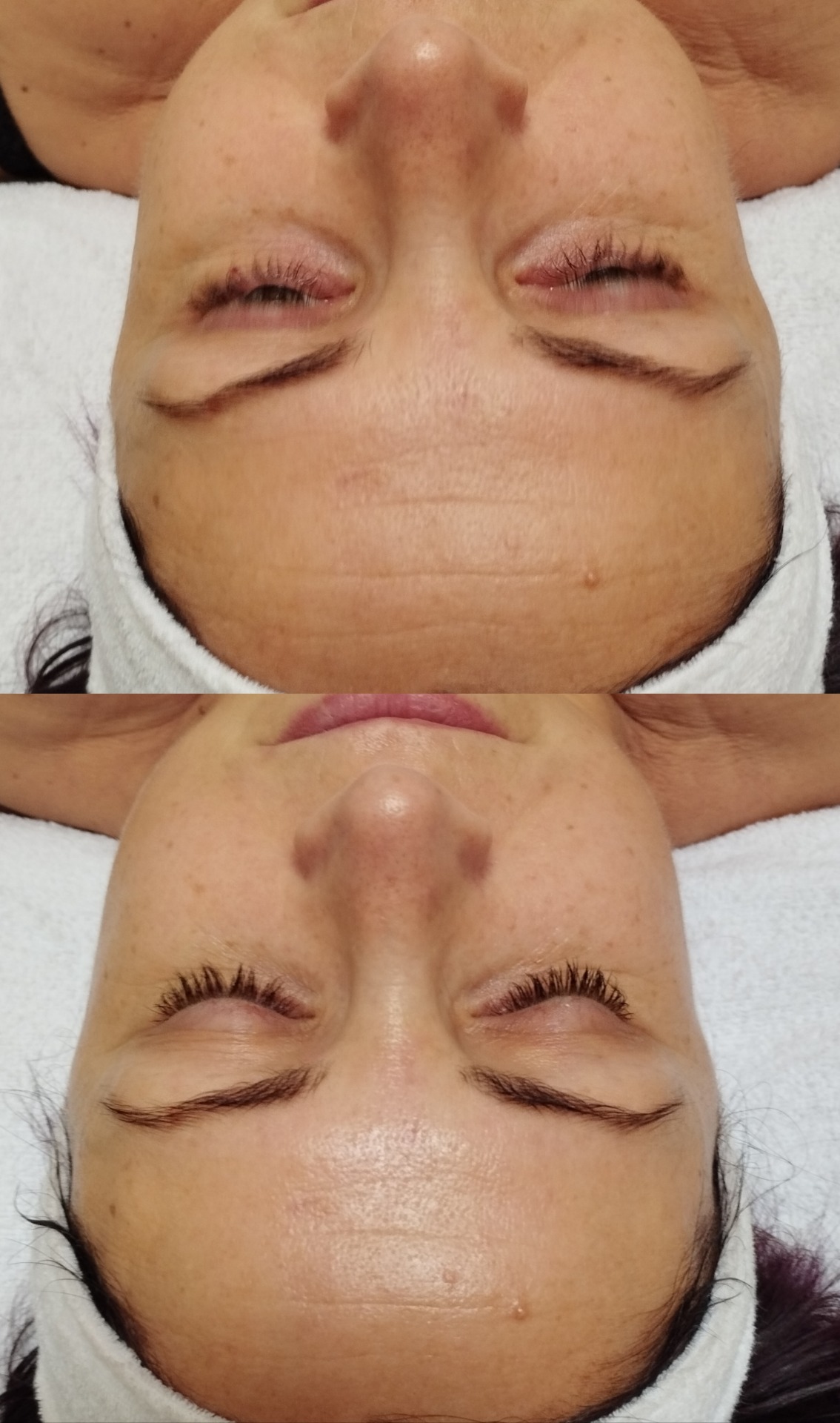 Maderoterapia a masáž tváre